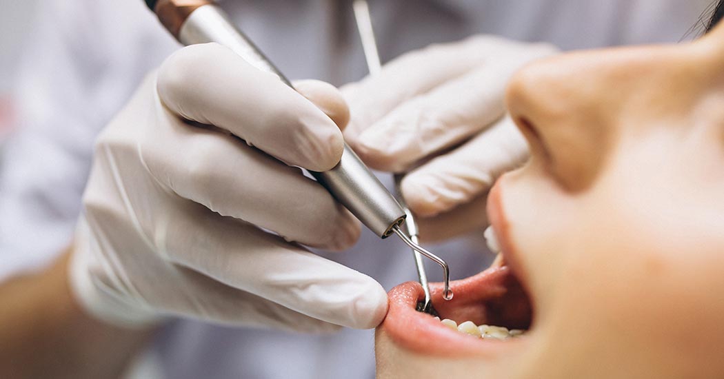 Endodonție